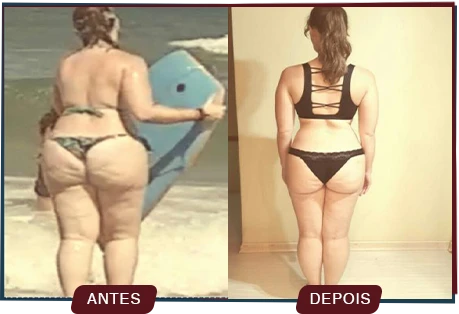 Antes e depois de paciente em processo de emagrecimento na Clínica Motivation